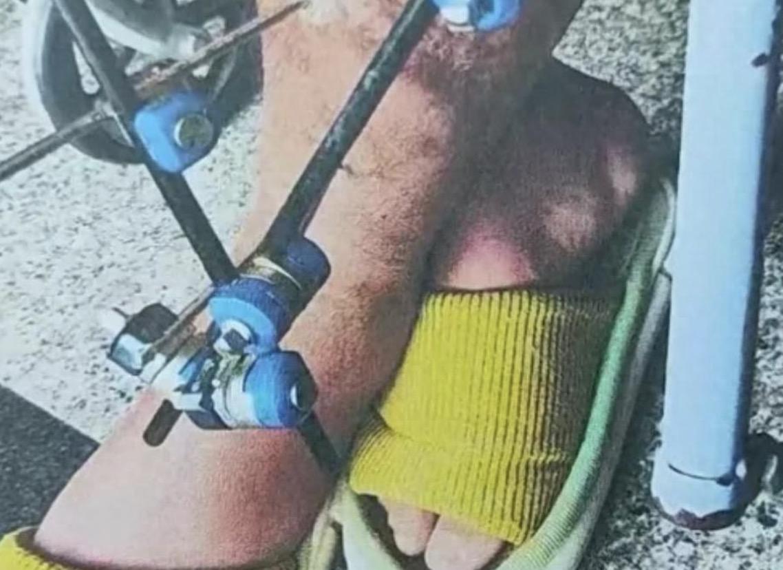 同样的手术耗材，自己去买的话只需要140块钱，可到了医院的话就变成了2200，一