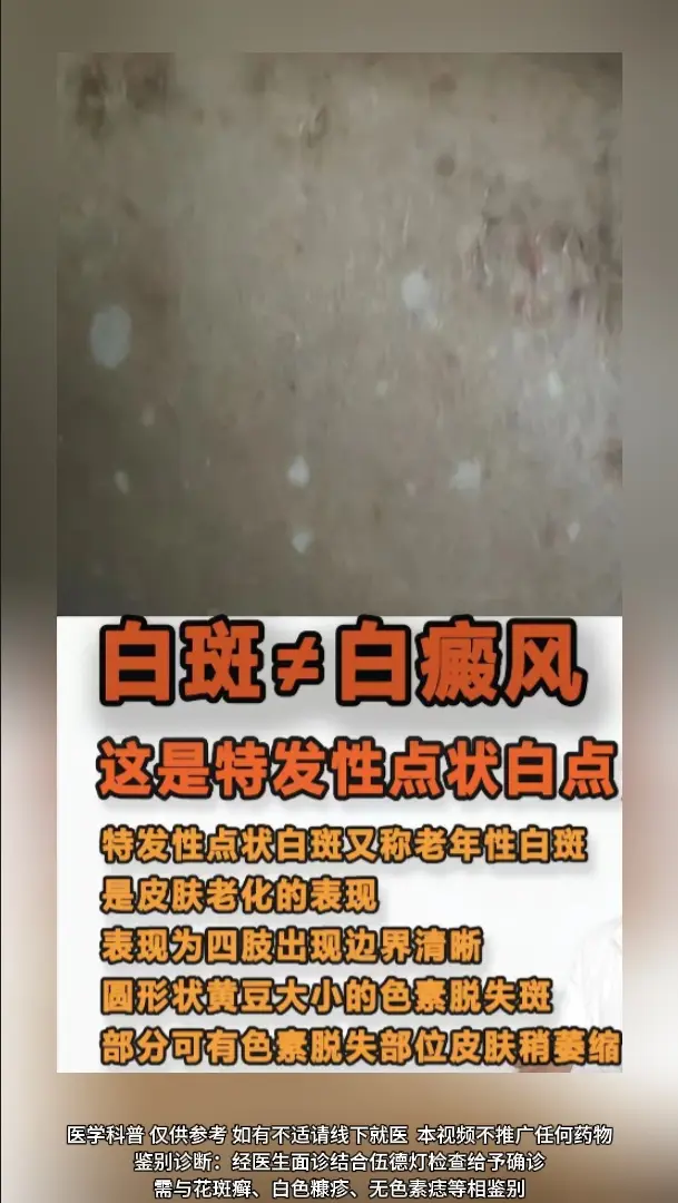 医学科普 白癜风 白癜风科普 白斑 硬核健康科普行动