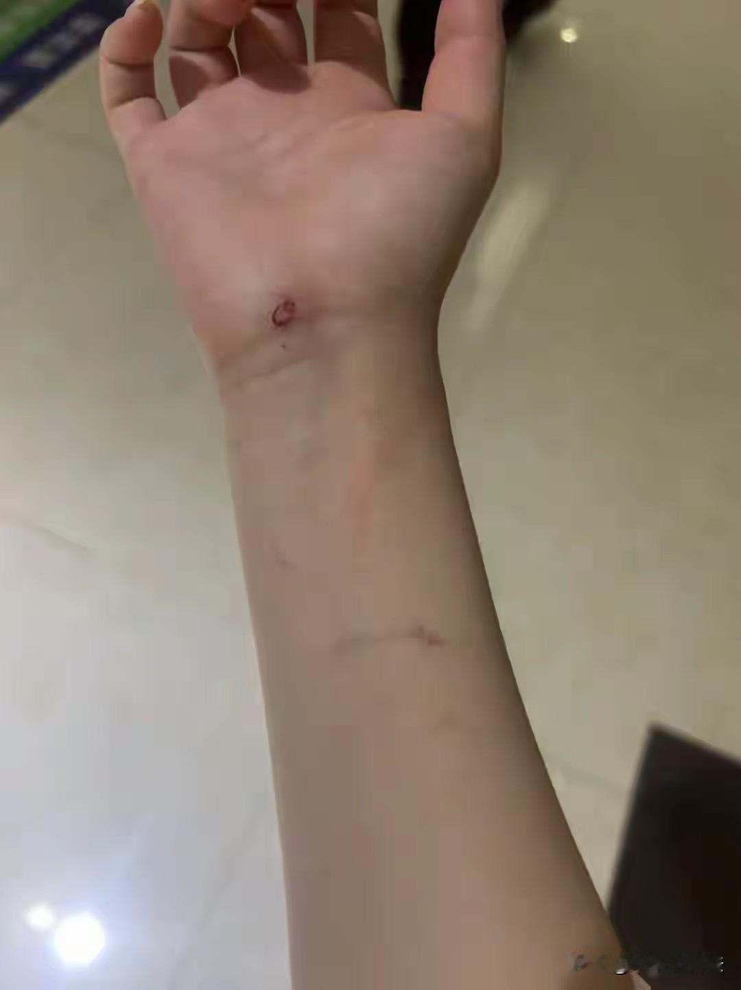 山东东营，女子出差在外，独自在家的18岁女儿被4个陌生人强行闯进家中，说其弟弟打