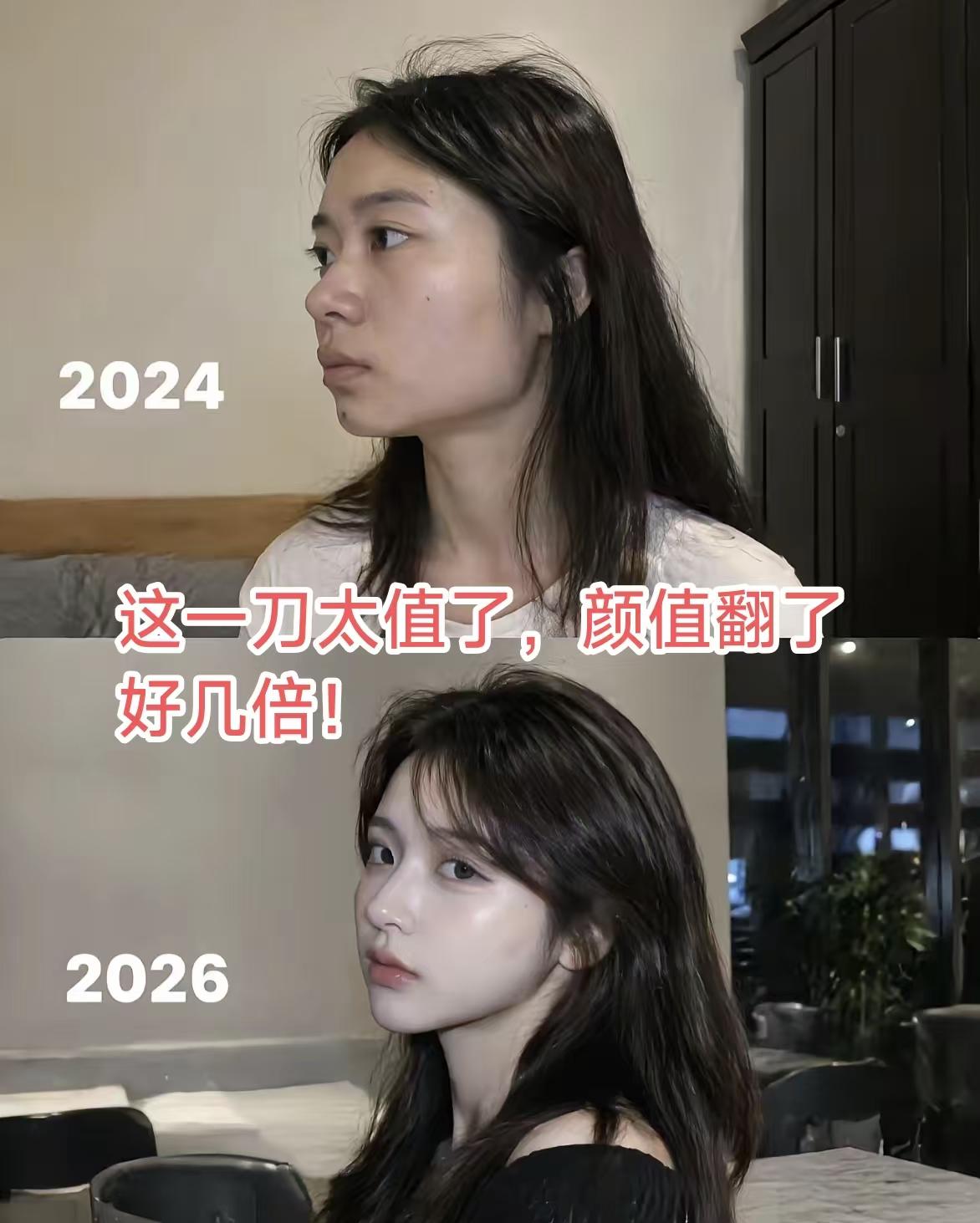 花多少钱整的？能不能透个底让我死心？