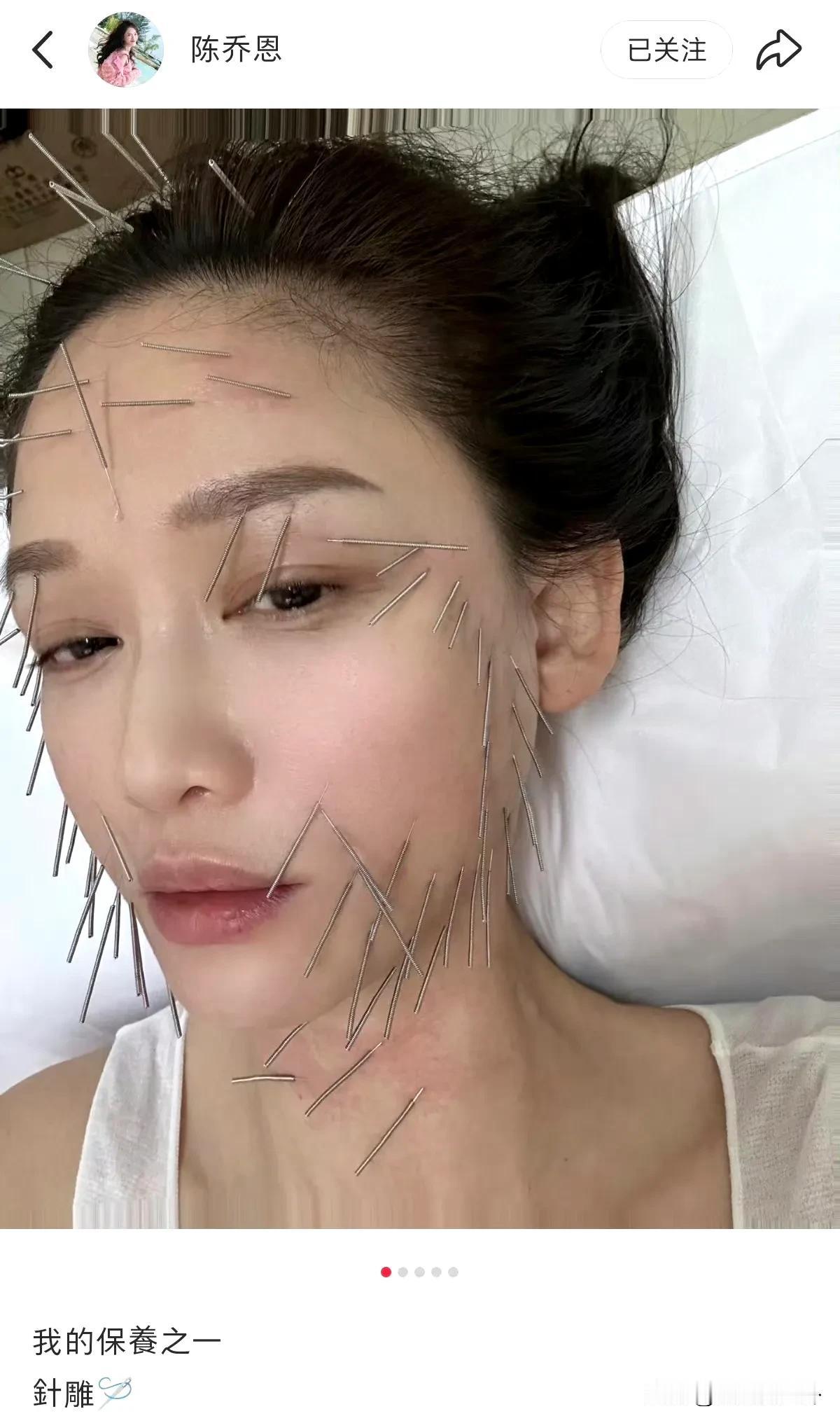 陈乔恩和网友大方分享自己的保养～～针雕，光看就觉得疼。好奇扎完不会有针眼吗？女明