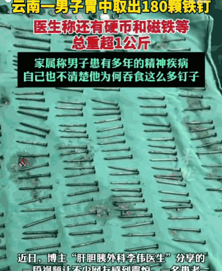解释不清了！云南，一男子腹部剧痛送医，医生检查后当场被吓退三分：他体内居然塞满了