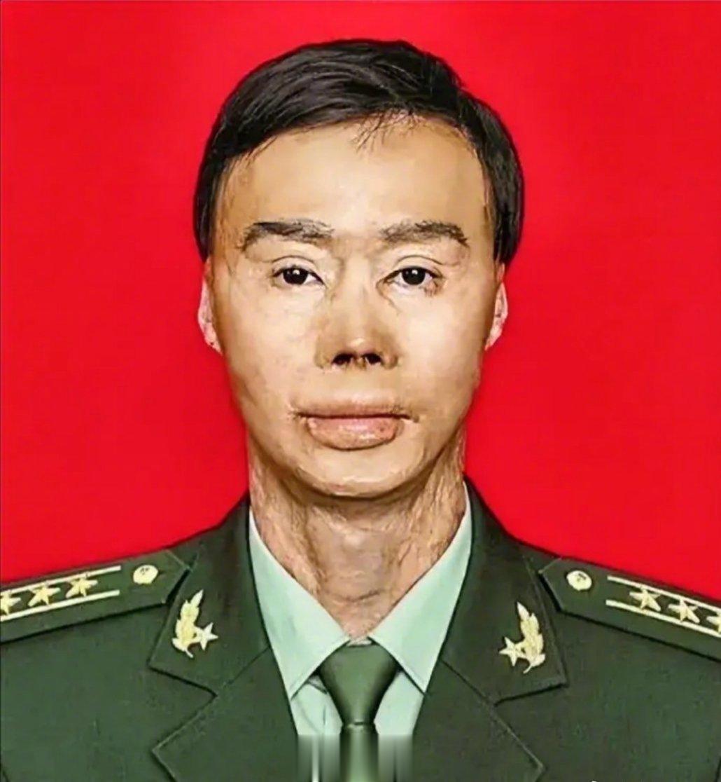 27名乘客得救了！梁强在回家探亲途中突遇车祸现场救出24名乘客，却付出了全身烧伤