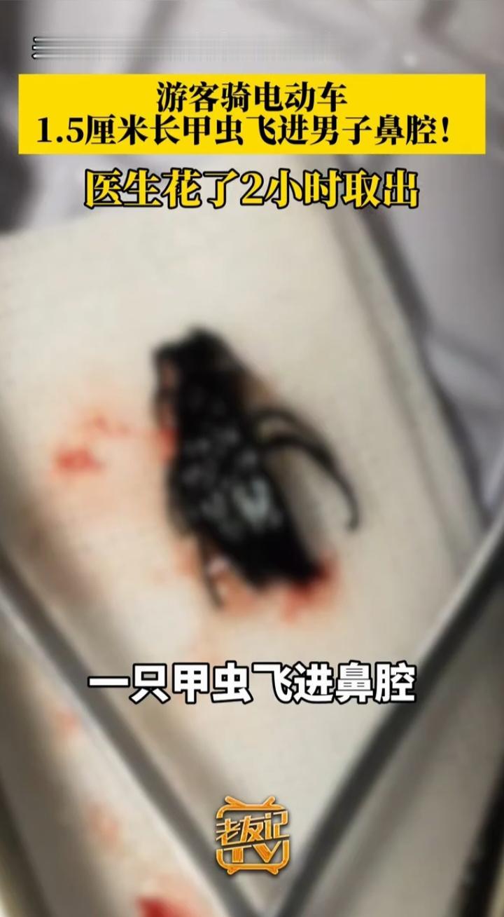 涠洲岛游玩，小虫飞入鼻腔！提醒大家：户外游玩千万别忽视微小的危险
 
出去旅游，