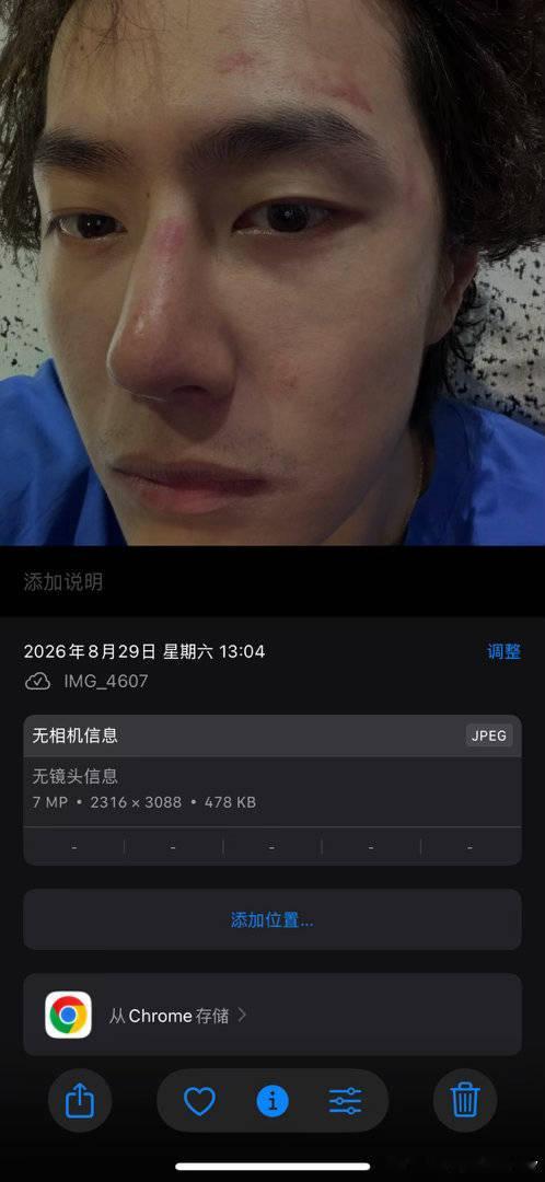 1 或者是拍个高清的更好卖惨这样蘸蘸就不骂我惹 ​​​