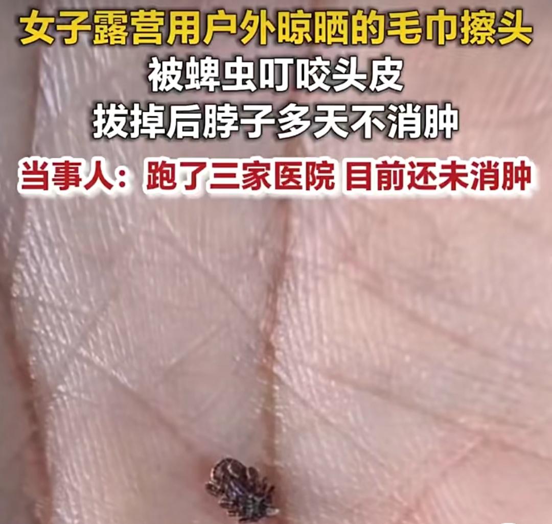"悔不当初！"6月11日，贵州贵阳，一女子露营洗完头，随手拿起在外头晾晒的毛巾擦