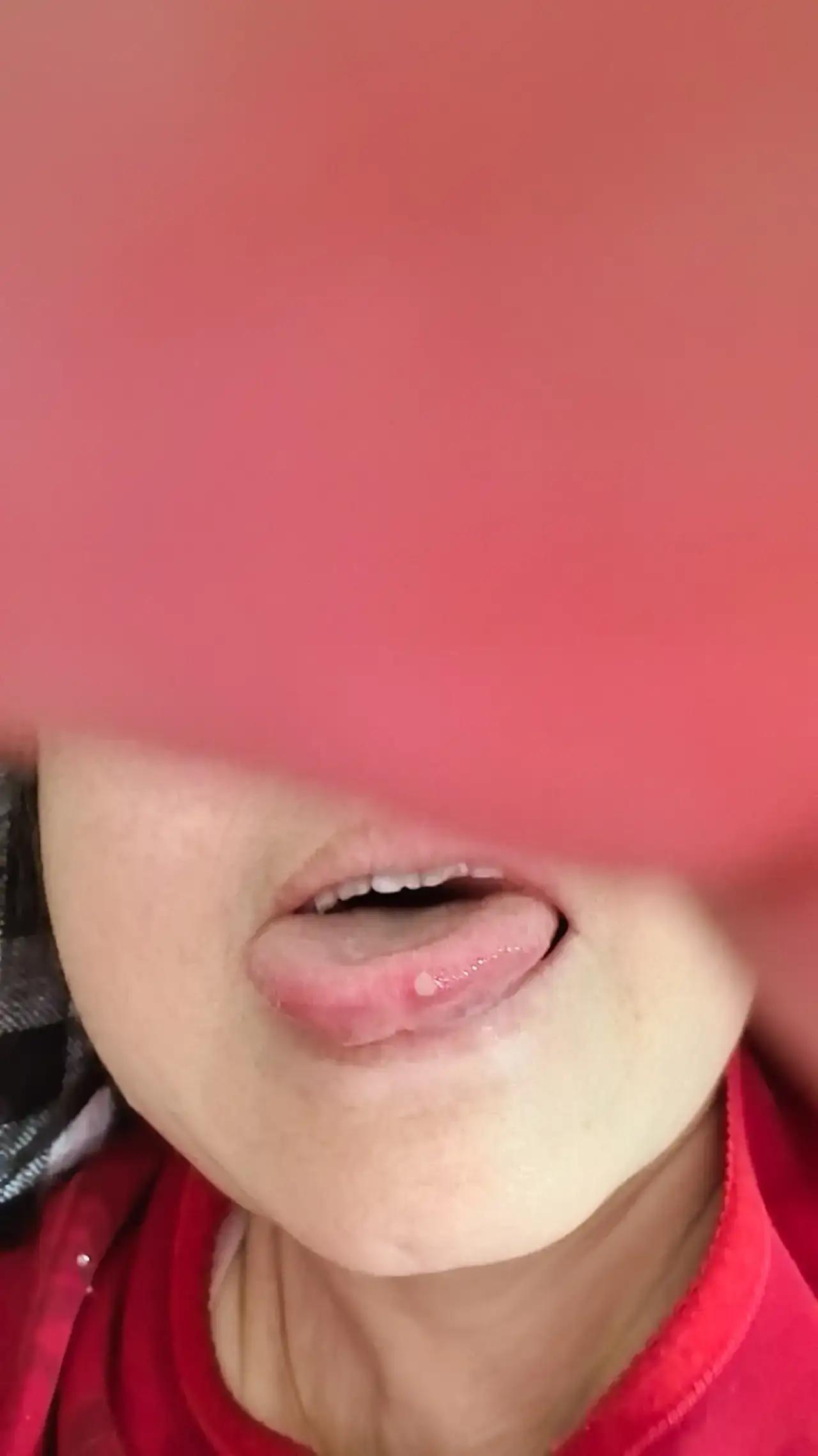 舌上“小毛病”：别把癌症当炎症，身心双调才是真修行

诸位朋友，今儿咱们单说这嘴