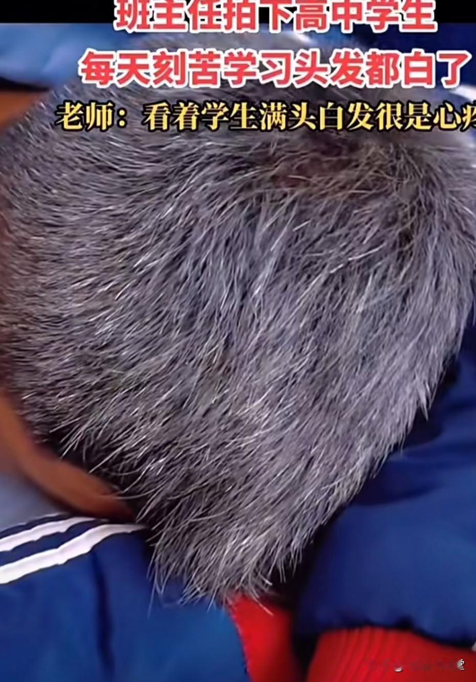 十七八岁满头白发！高三学子藏在青丝里的拼搏，看哭无数家长
 
本该青丝如云、朝气