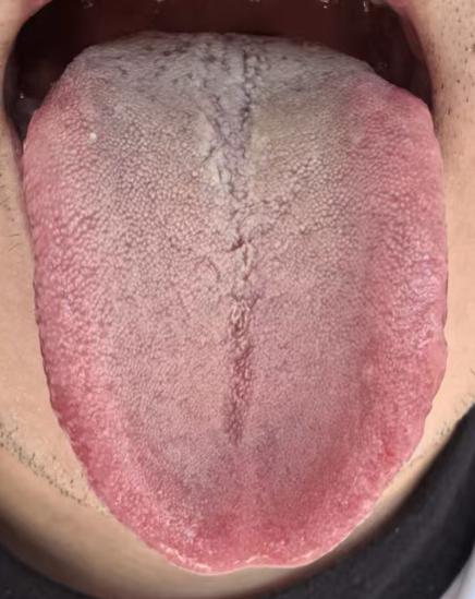 理气通络养气血，化解体虚阻滞，稳固身心状态






很多朋友最关心的是如何可
