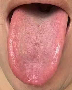 中年体虚的中医调理逻辑：分步改善机能状态







很多男士朋友们年轻的时候