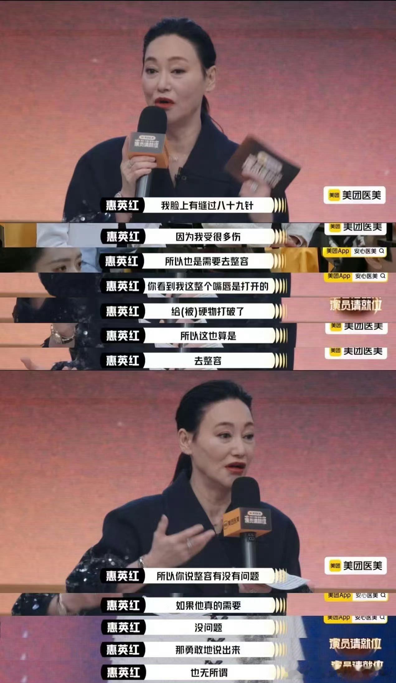 惠英红脸上缝了89针 多少？你说多少？89针？？？我的妈呀，这恢复了得多大一个疤