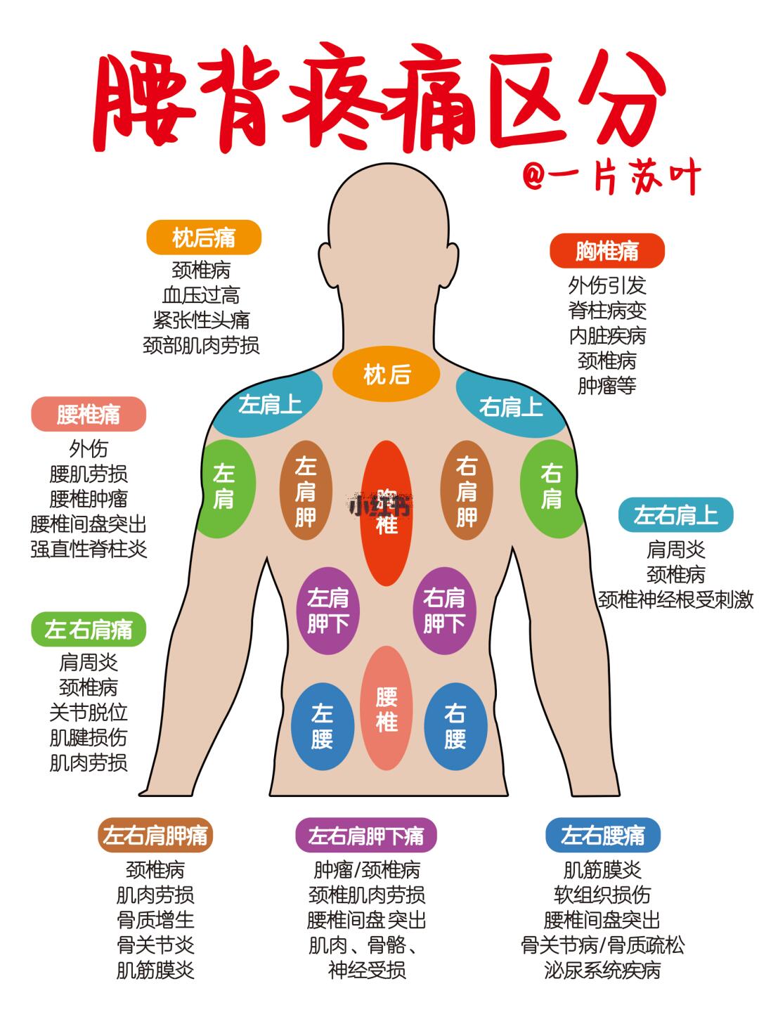 手写笔记✅一张图区分腰背疼痛‼️