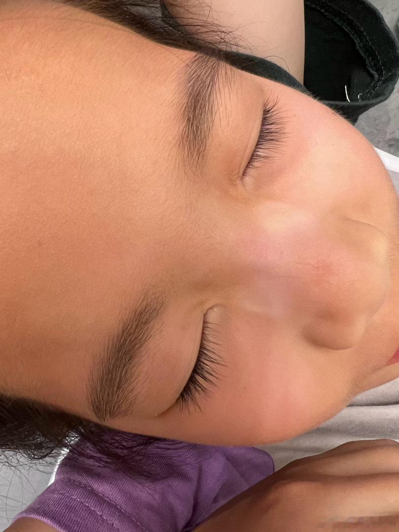 柚柚昨晚回来直接睡了早上起床人都是蒙蒙的人晒的呀黑的很正鼻翼被眼镜压着的地方是白
