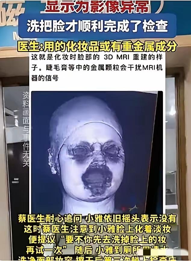 福建一个29岁姑娘去做头颅磁共振，差点没把医生整崩溃。
连着扫了两次，机器都提示