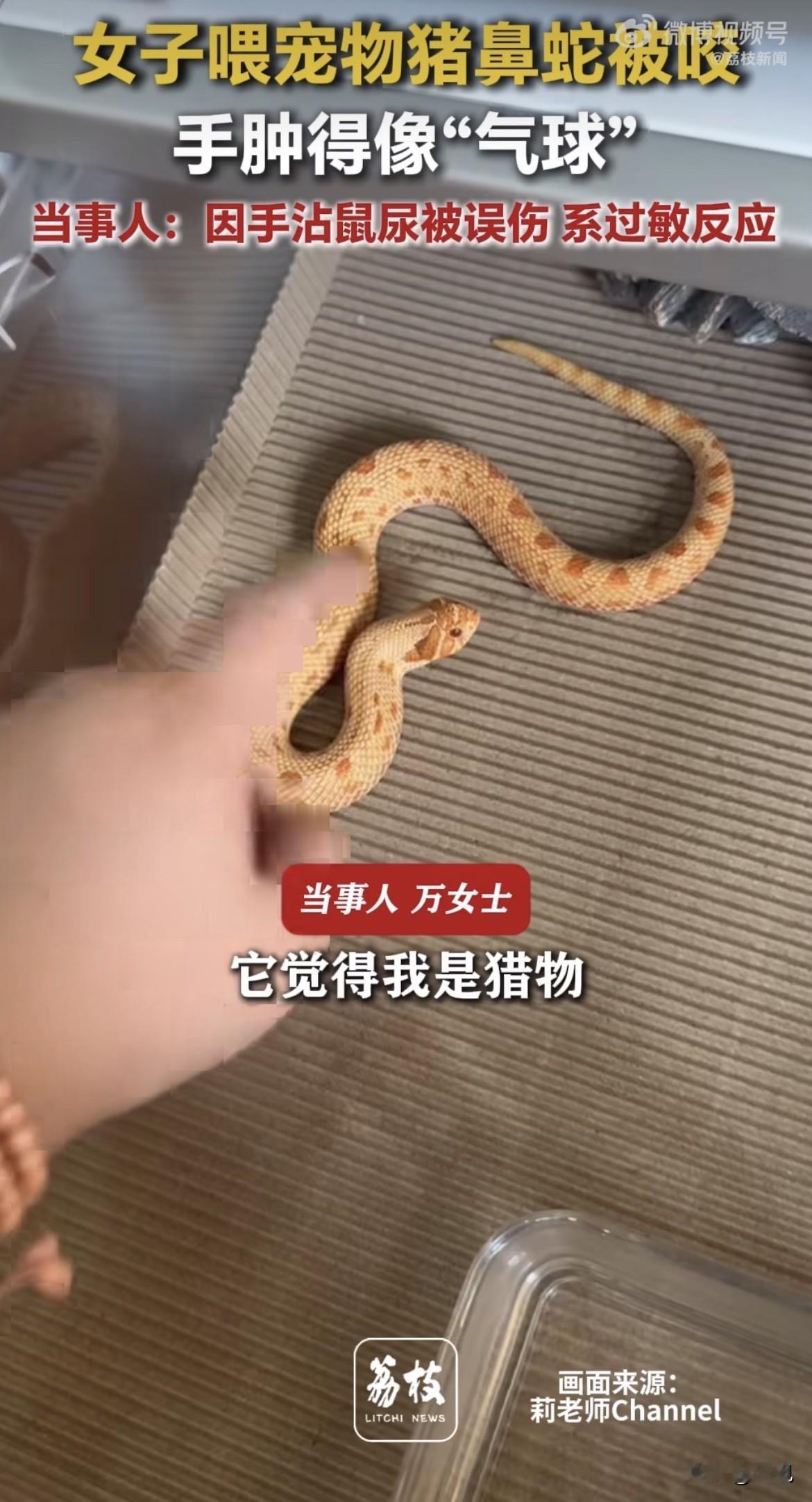江苏淮安的万女士，手肿成了一个气球。

5月12号那天，她在家喂蛇。养的是条猪鼻