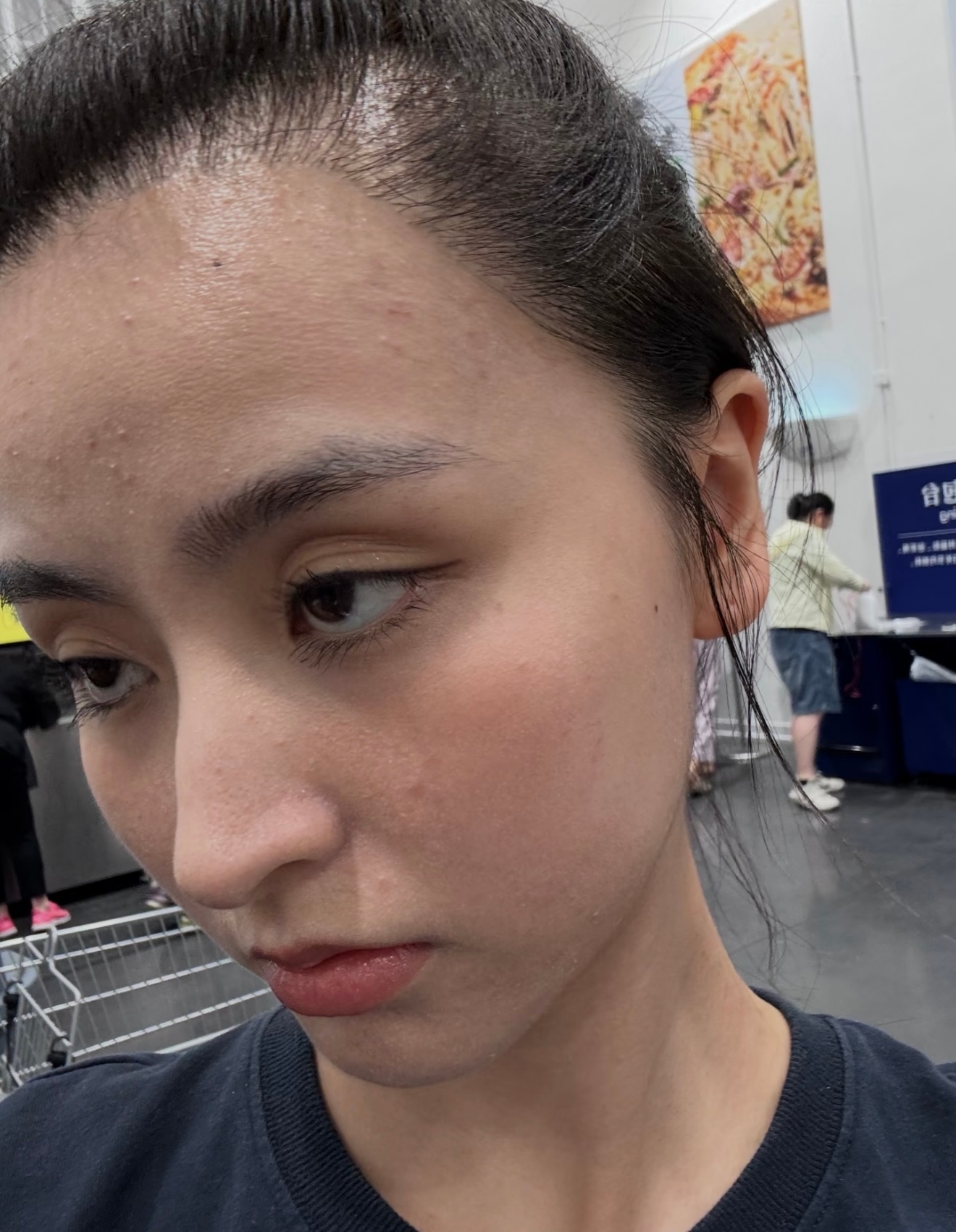 金子涵自拍照金子涵的近照金子涵晒出新自拍，自曝患上白癜风已有三年，不少网友留意到