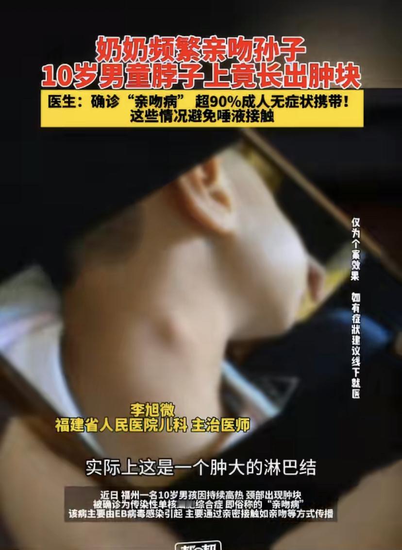 最近在福州发生了一件事，挺让人警醒的。一位奶奶因为太疼爱10岁的孙子，经常亲他，
