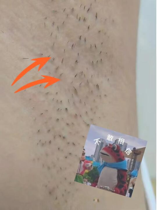 呵呵呵，真的被脱毛仪劝退了。。