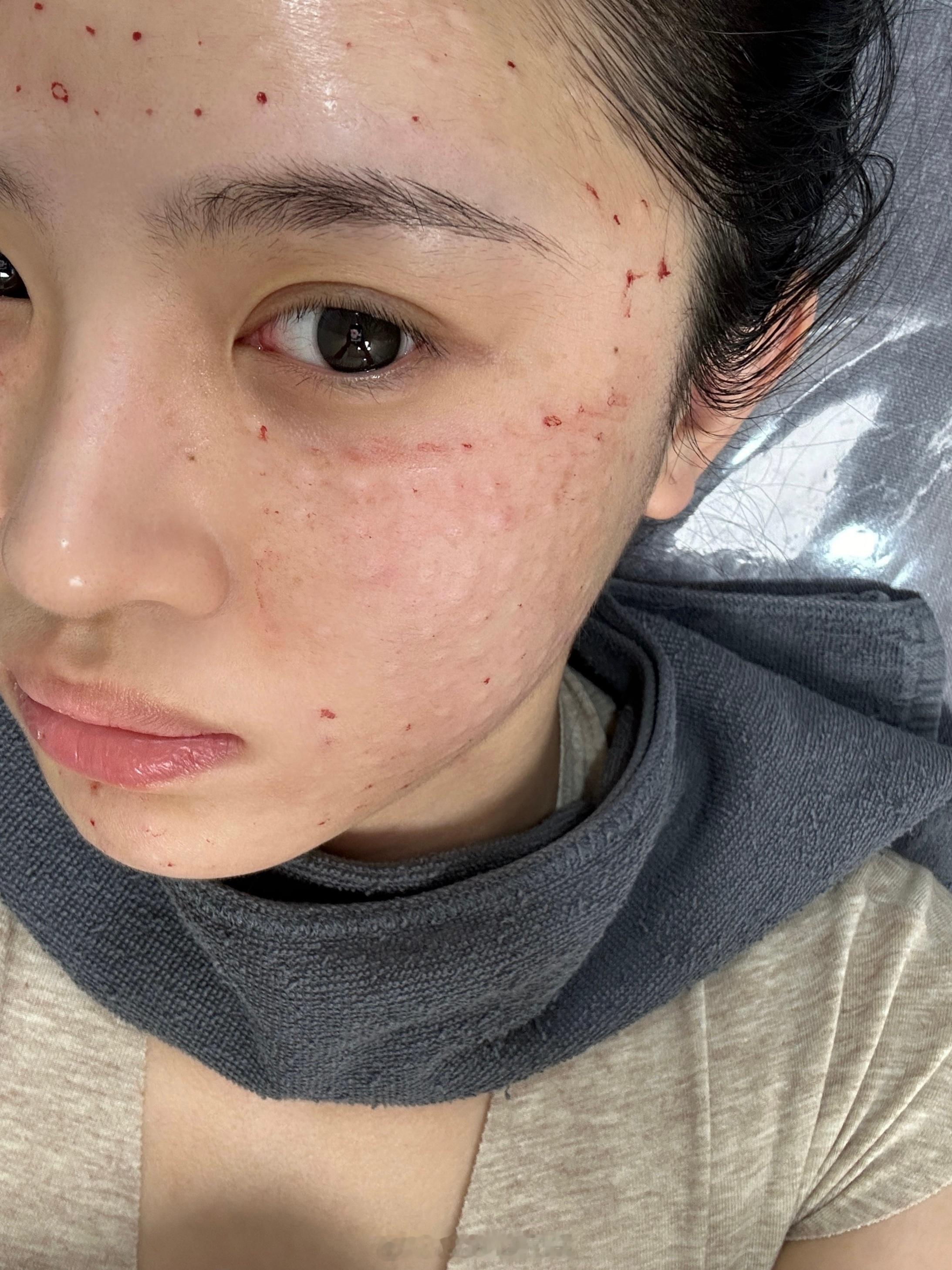 丽珠兰好痛啊😭 ​​​