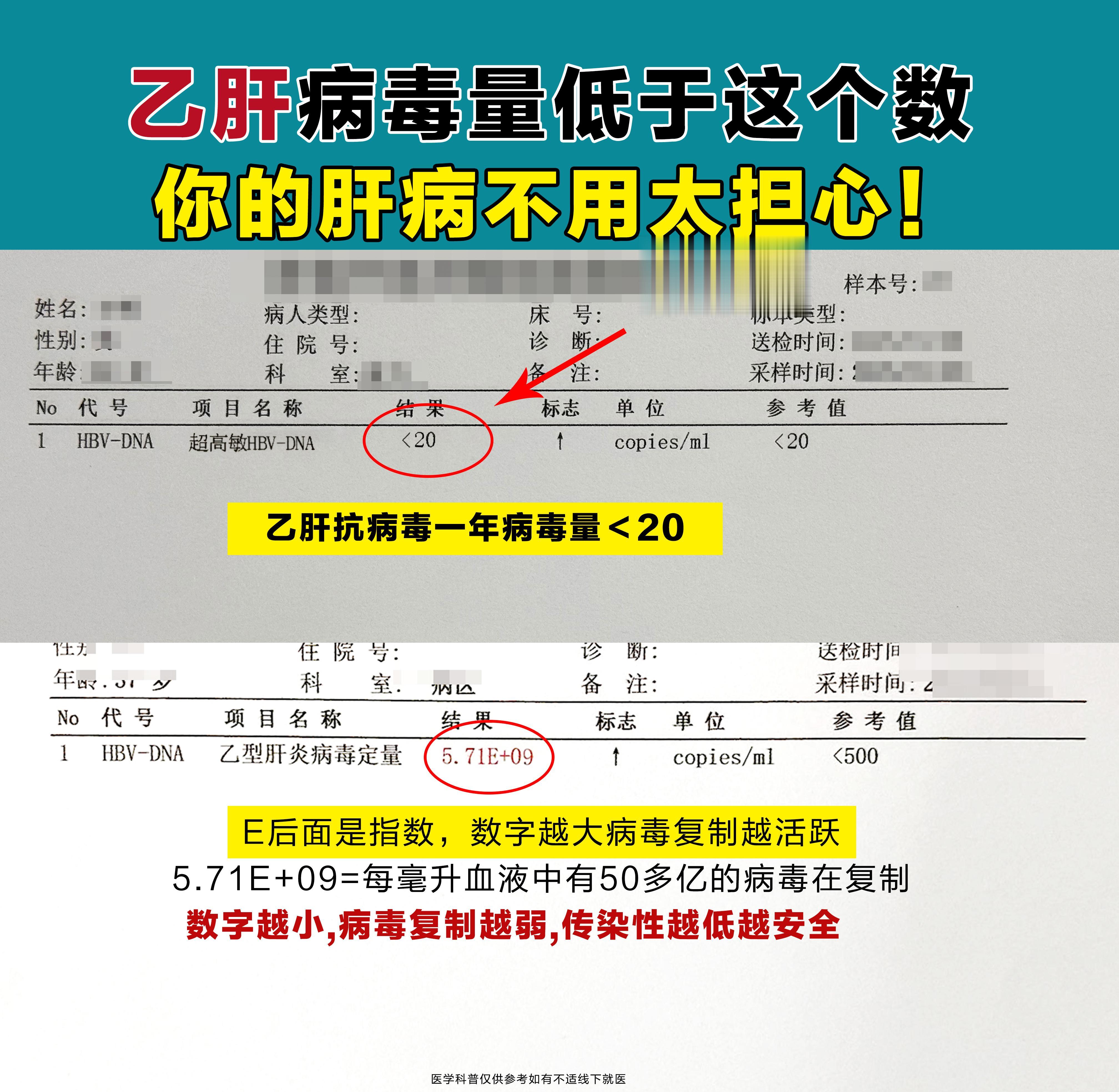 乙肝患者抗病毒一年以上，大部分的患者都能实现病毒学的转阴，病毒得到有效...