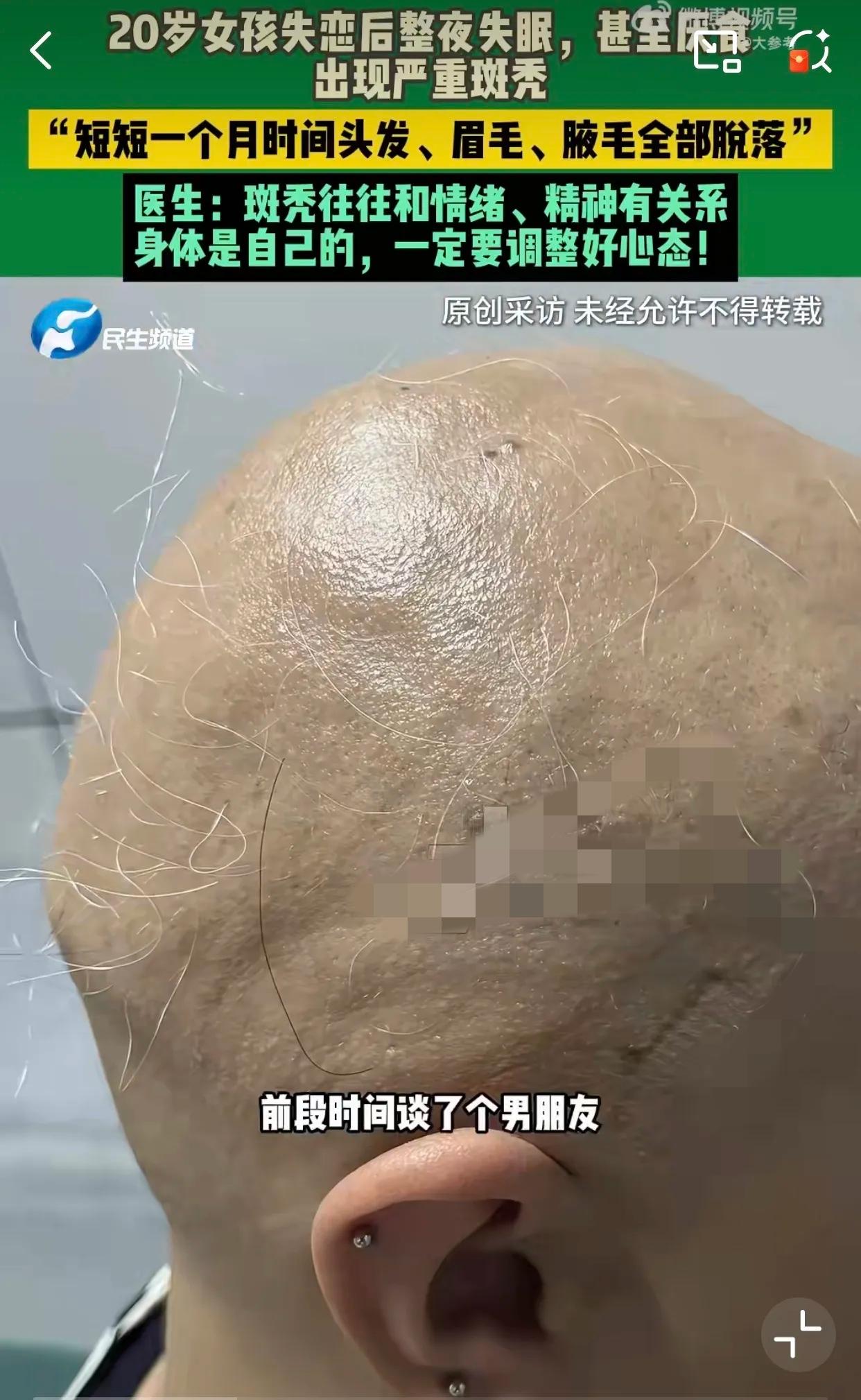郑州这姑娘太让人心疼了！才20岁啊，为了个说分就分的男生把自己折腾成这样，真的不
