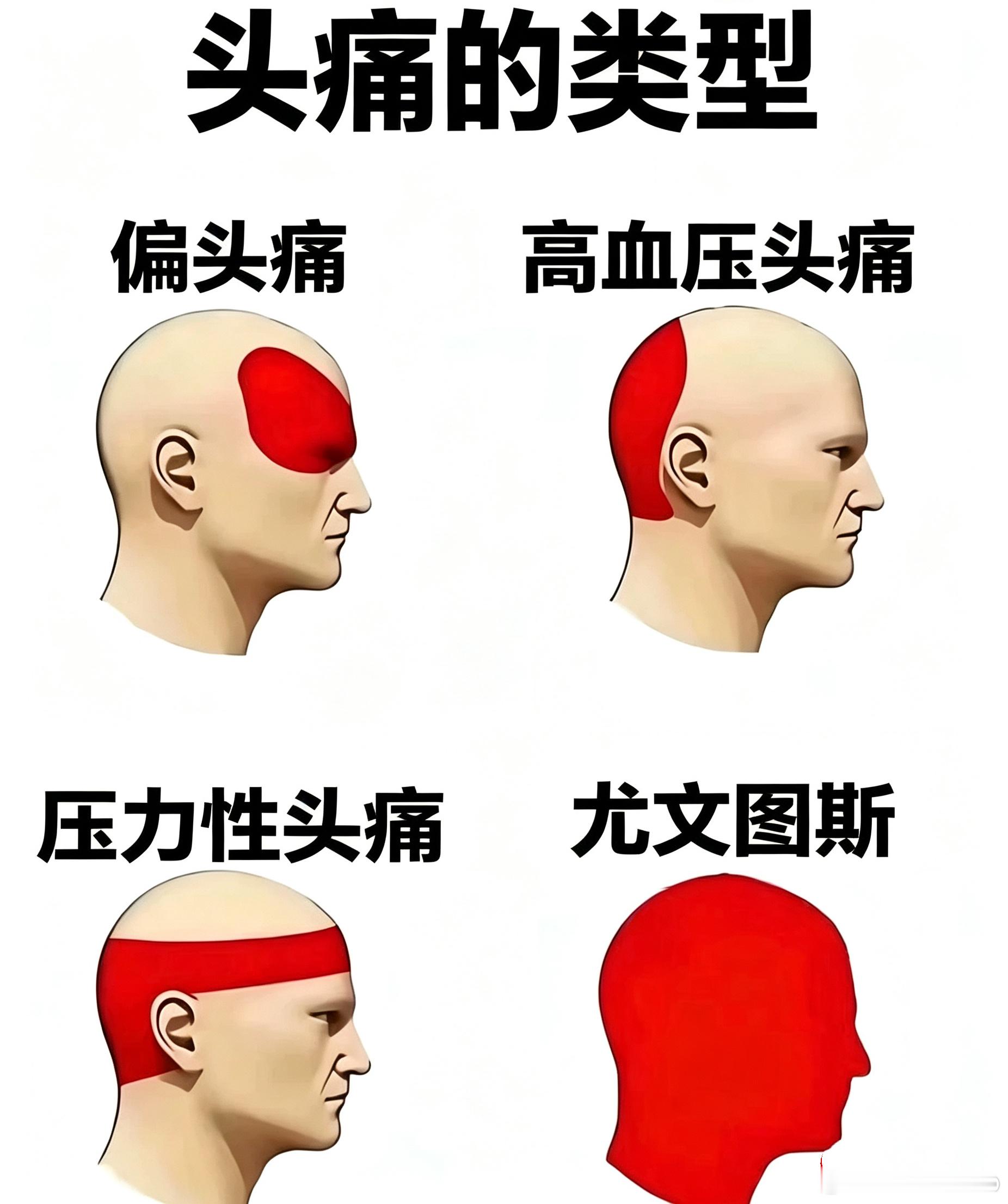 我的头痛分为好多种。[允悲] 尤文图斯[超话] ​​​