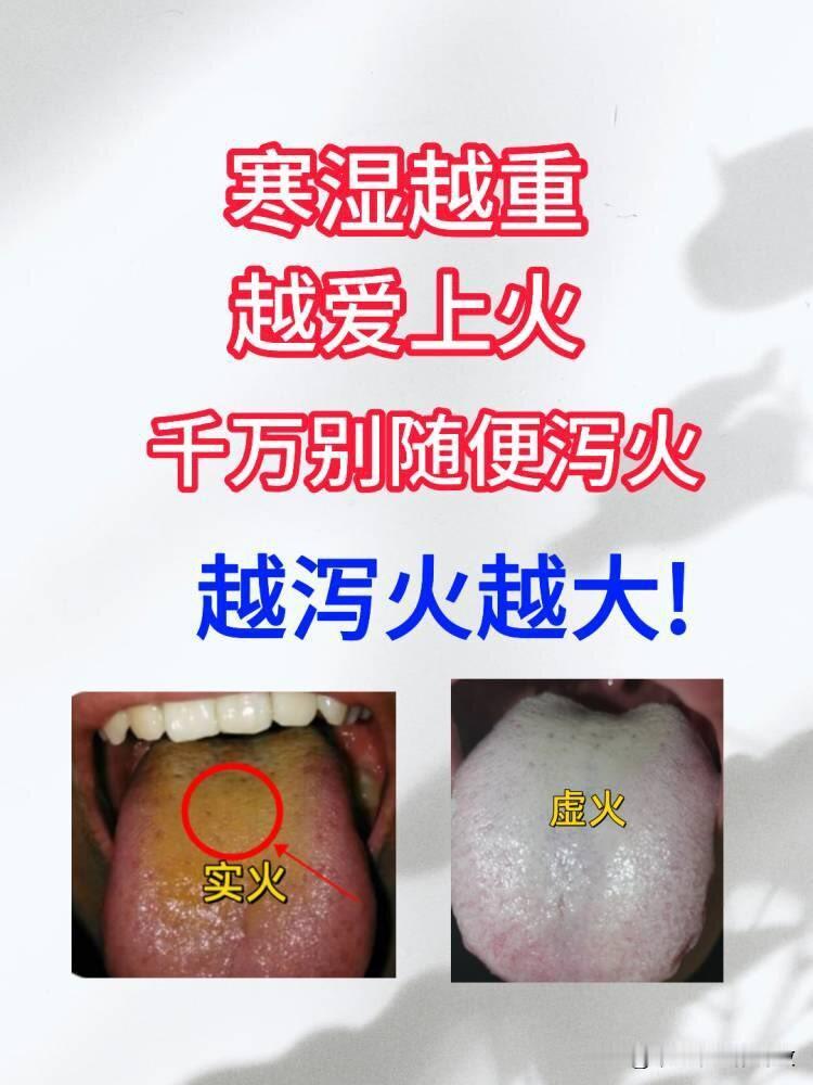 寒湿越重越爱上火[赞][赞]
千万别随便泻火越泻火越大!
实火，虚火，两种舌象分