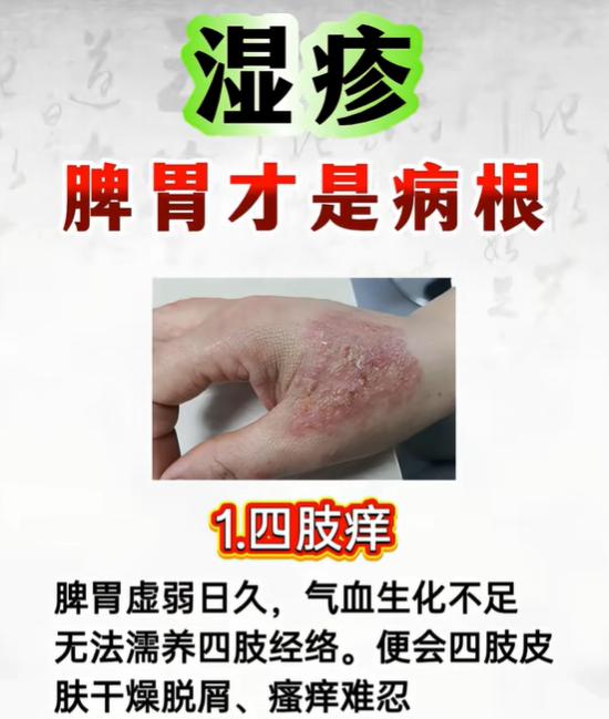 四类皮肤瘙痒湿疹辨证：皆由脾胃运化失常引发