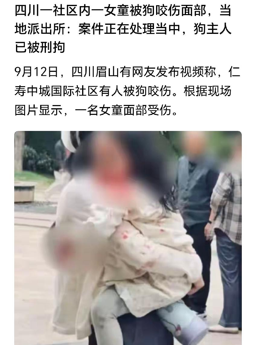 女童面部遭犬只咬伤，9月12日，四川一处社区内发生了一起犬只伤人事件。
这几点如