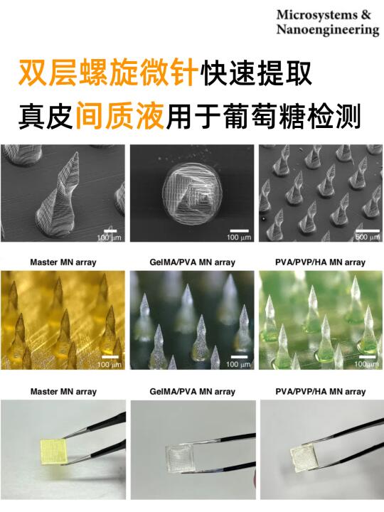 双层螺旋微针快速提取间质液用于葡萄糖检测