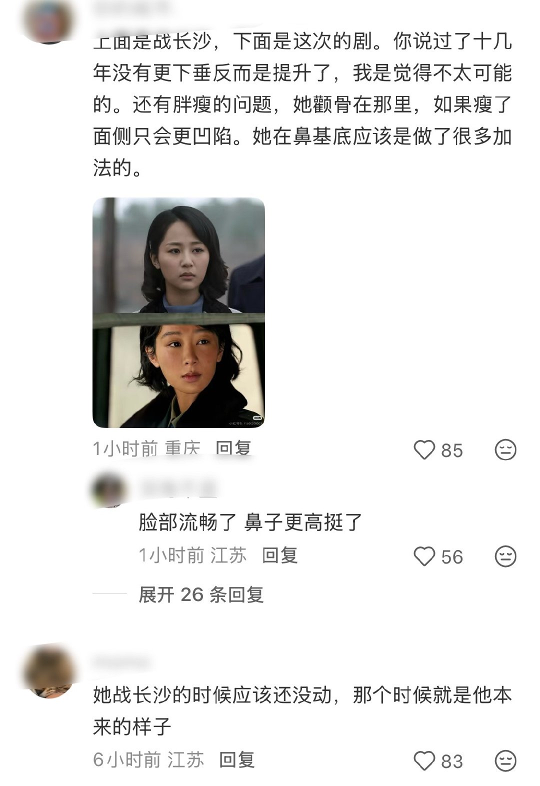 括号型法令纹资深研究者，鼻基底改造实践专家 