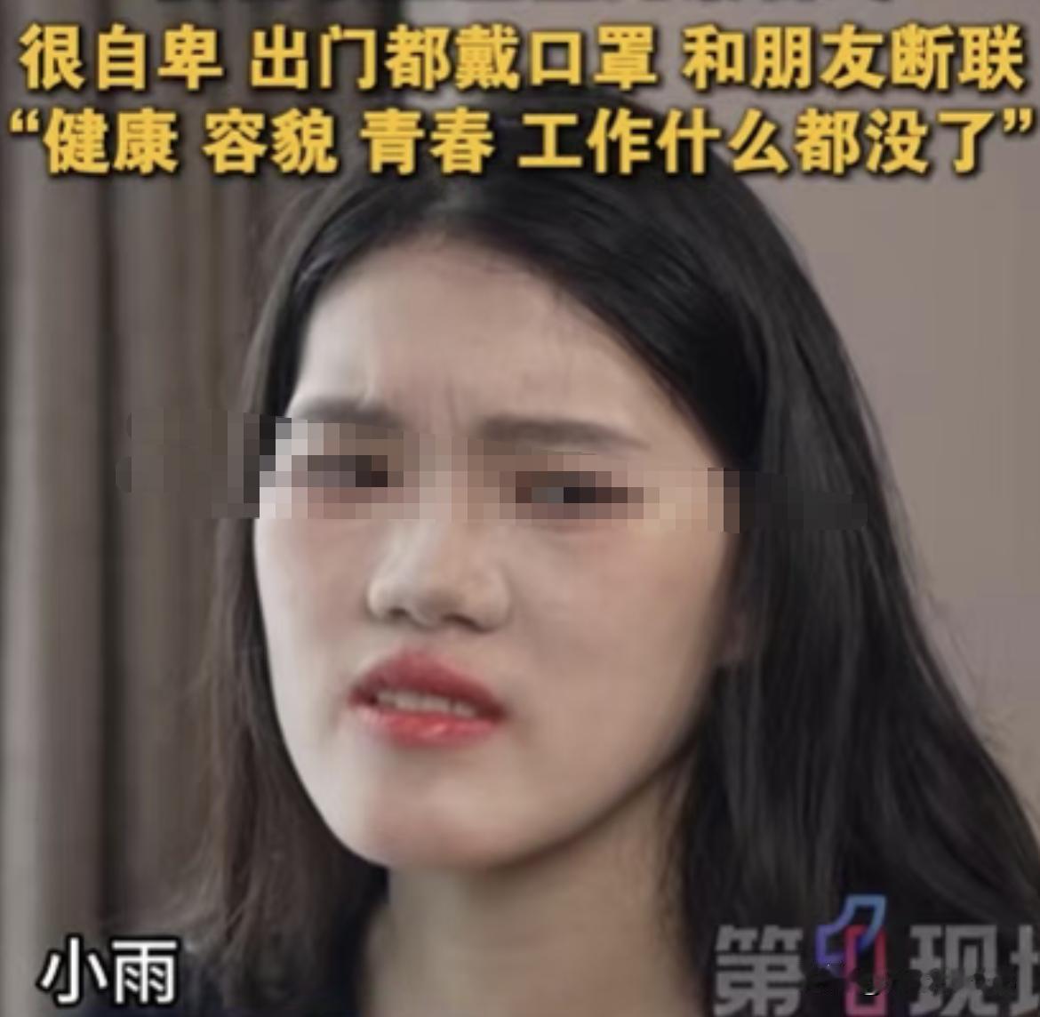 女孩的脸被整成“鞋拔子”，
这事儿原来不是哪个黑心医美干的，
而是公立三甲医院，