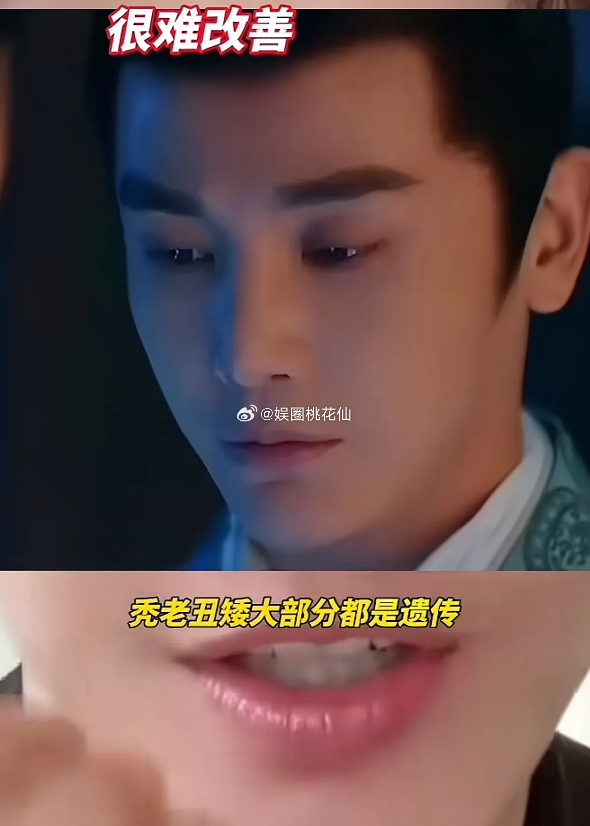 孙坚说：“我跟大家说一个非常残酷的事实，秃老丑矮大部分都是遗传，很难改善。”网友