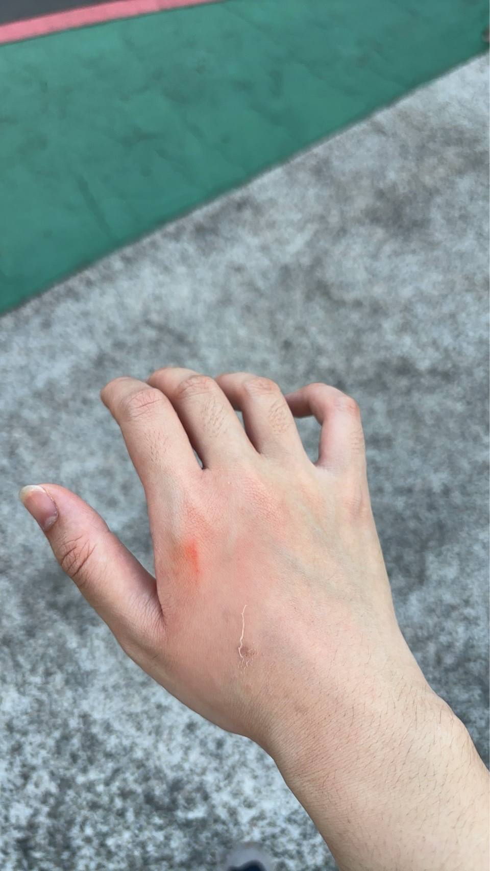 好痛超级无敌痛 感觉骨头被夹扁了刚刚去订给母上大人的蛋糕走的时候，被厚重的门夹到