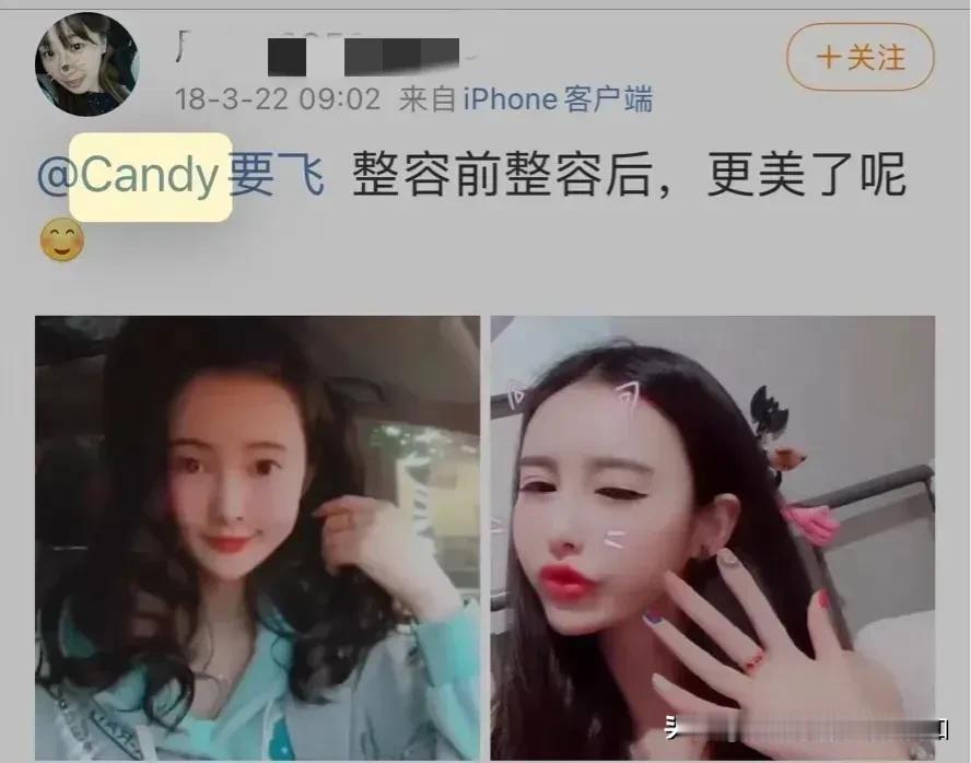诬陷雪梨吸毒的那名“富婆”身份被扒光！本身就是一名靠整容上位的网红，根本不是正印