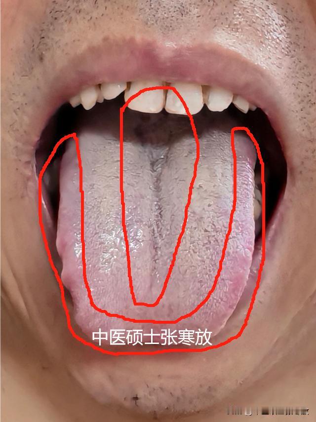 这裂纹都想把舌头裂穿了，这身体得亏成什么样啊[狗头][狗头][狗头]
晚上睡不好