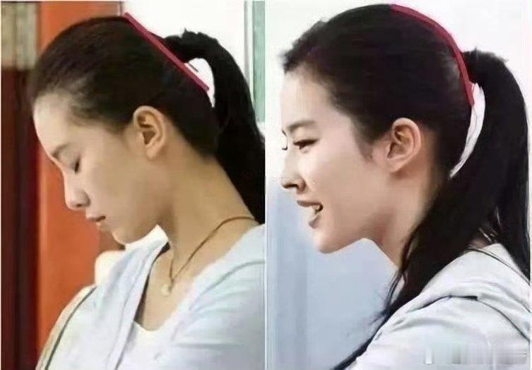 之前网上说刘诗诗颜值不如刘亦菲是因为扁头输给了圆头。结果刘亦菲居然也是扁头？你告