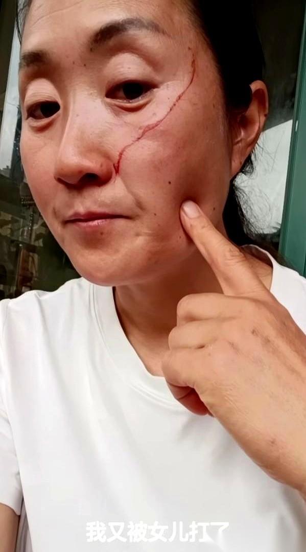 一年三百六十五天的当牛做马，换来的是亲生闺女甩在脸上的一个巴掌。
脸破了，血印子