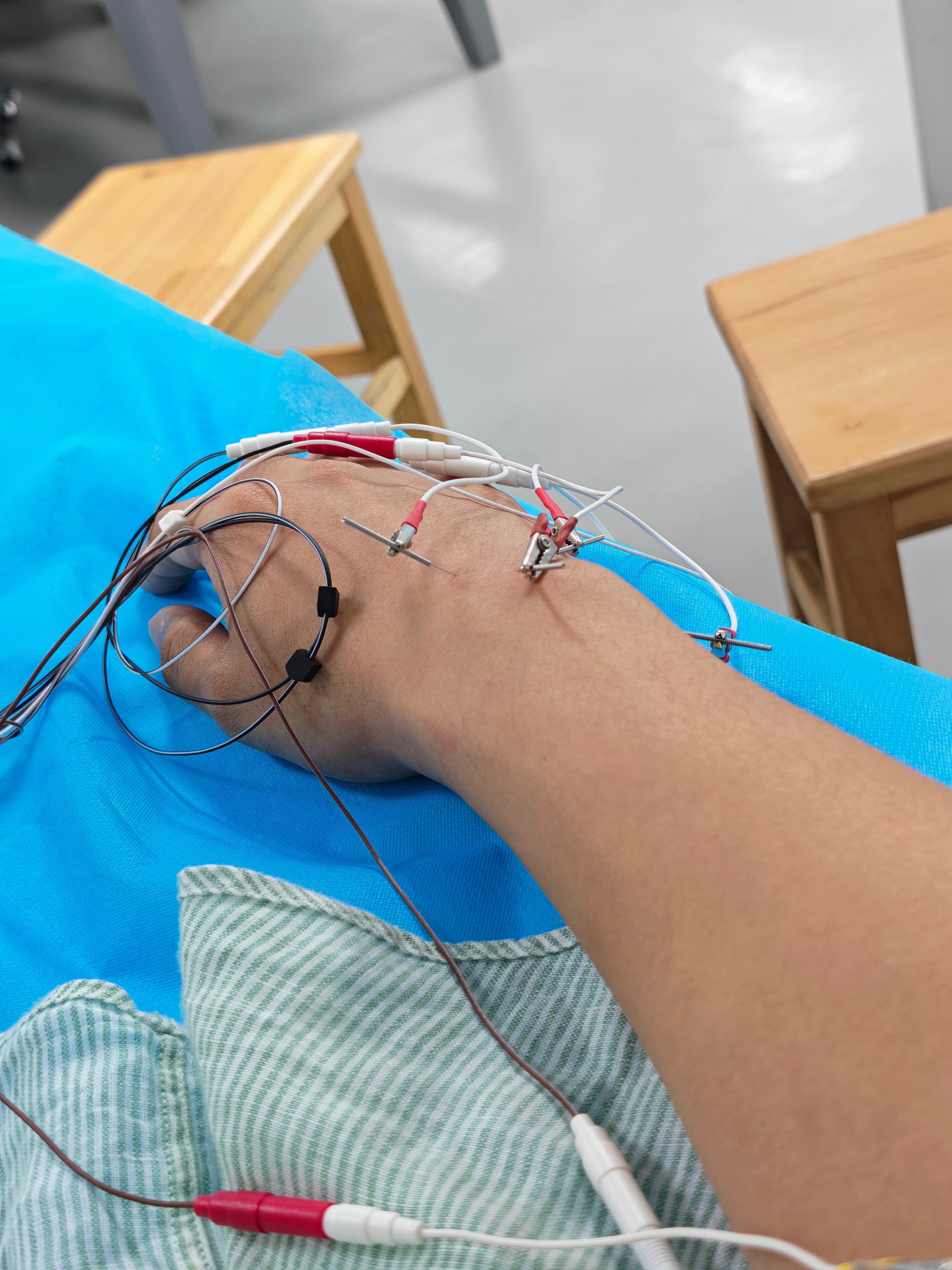 健身两年没怎么受伤，攀岩两周每次都受伤，在犹豫要不要接着玩了