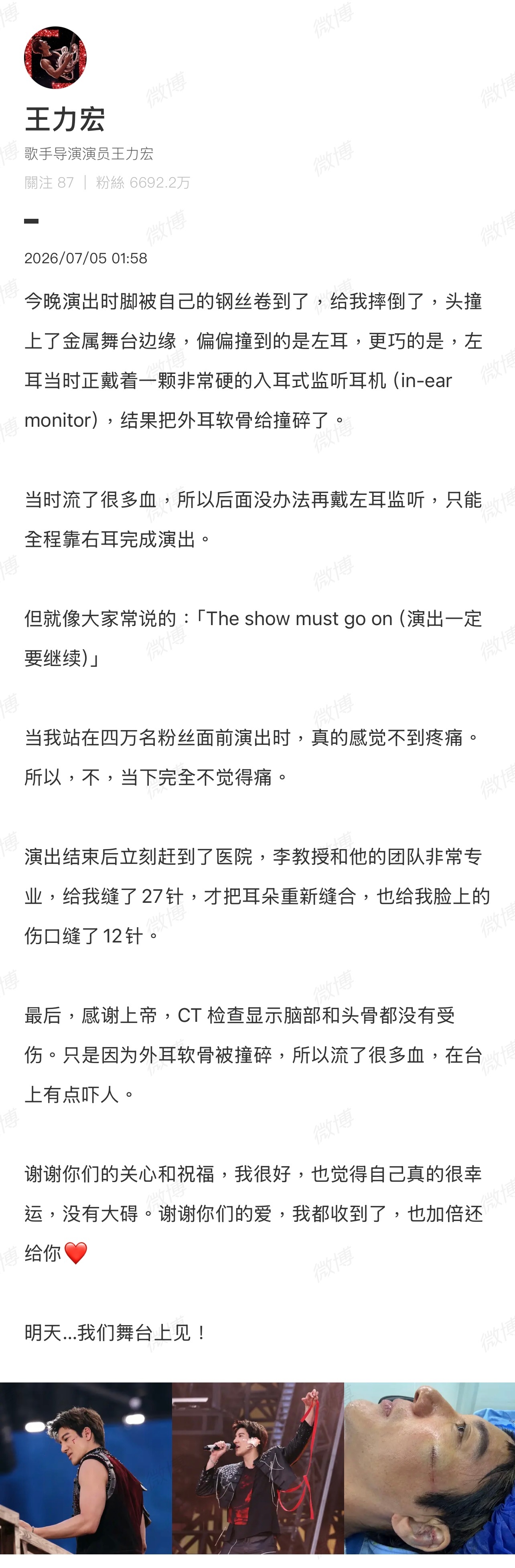 王力宏在舞台上摔倒，缝了 39 针！王力宏缝了39针王力宏事故责任人员被调查