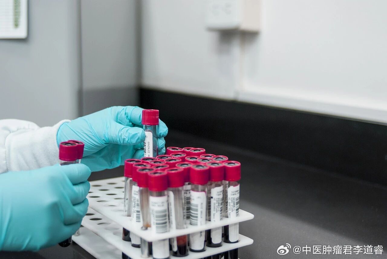 【血常规对肿瘤防治有什么作用】健康科普肿瘤防治科普  在医院，有一项检查就是种神
