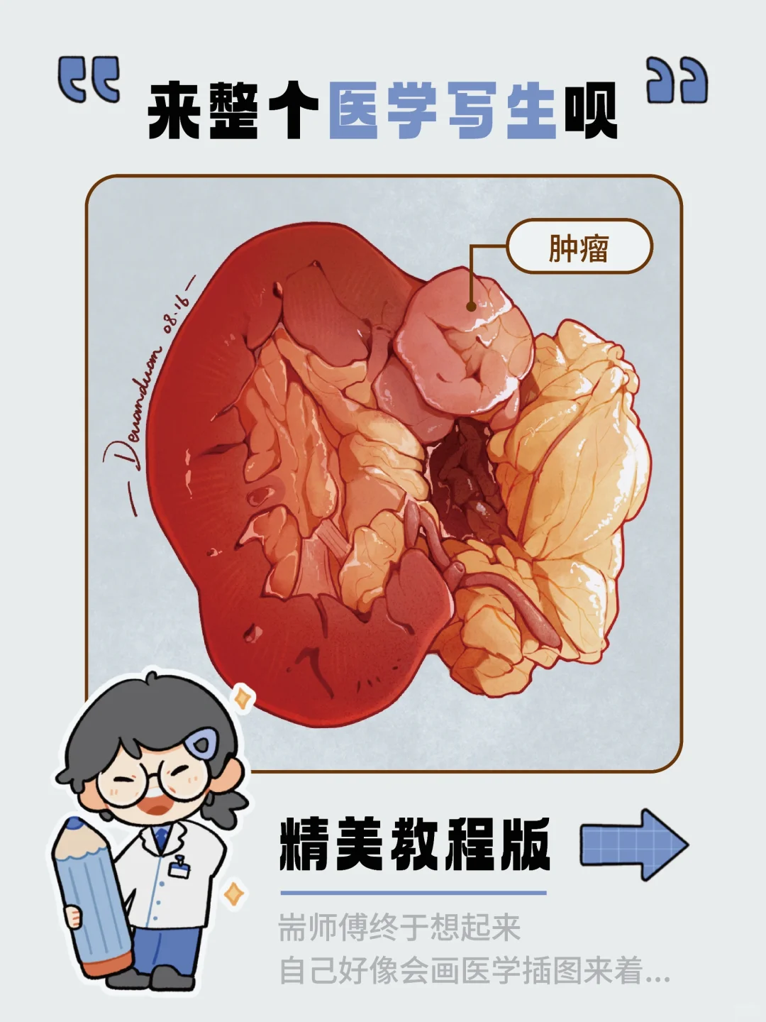【医学插画教程】写生一张手术标本（肾）