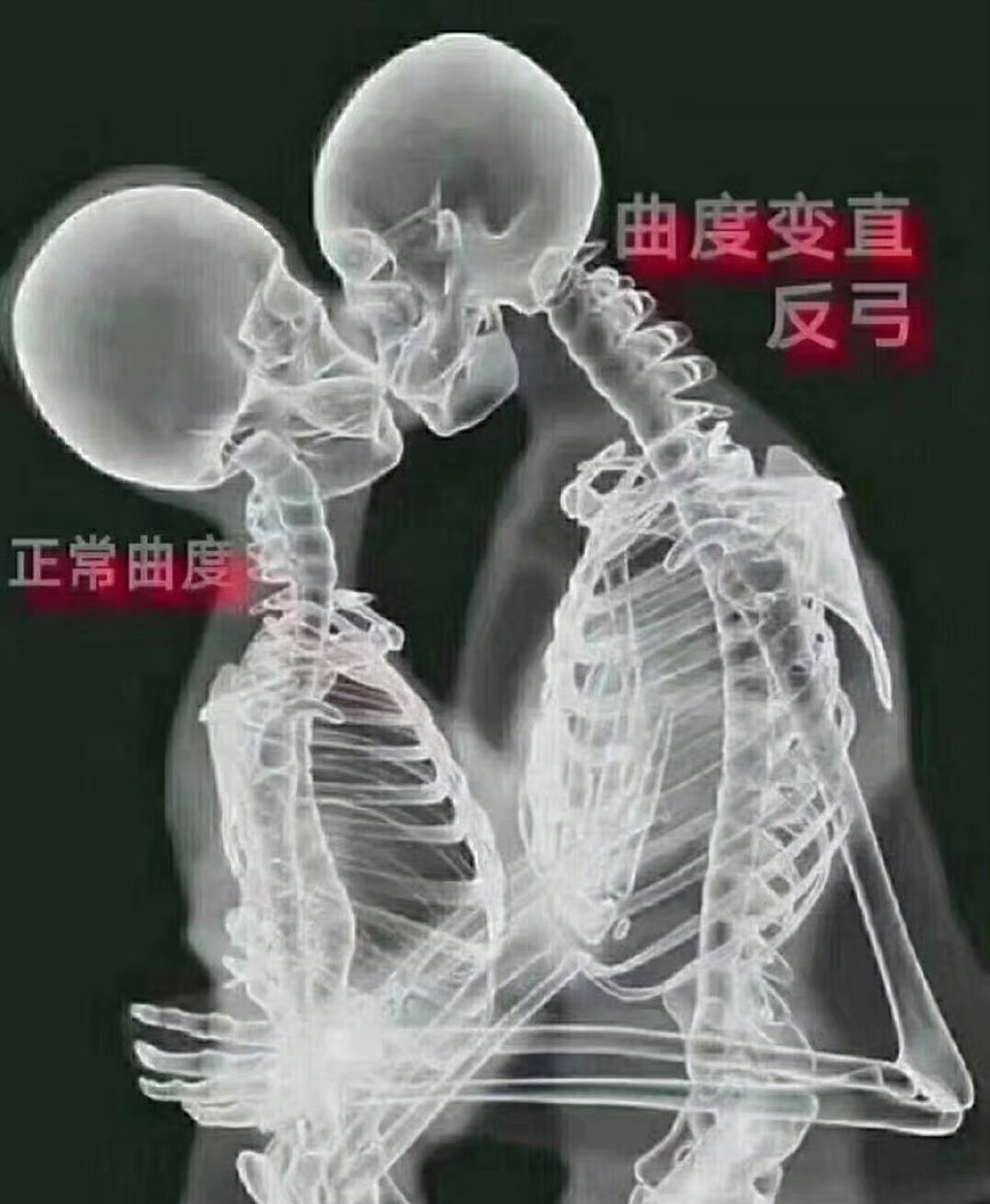 原来接吻还有这么多讲究不好意思，看到这个话题，我满脑子都是这个图康复师的职业病，