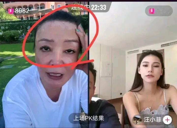 张兰汪小菲直播连线，婆媳俩共“打江山”成为企业助力
不过值得一提的是张兰白癜风也