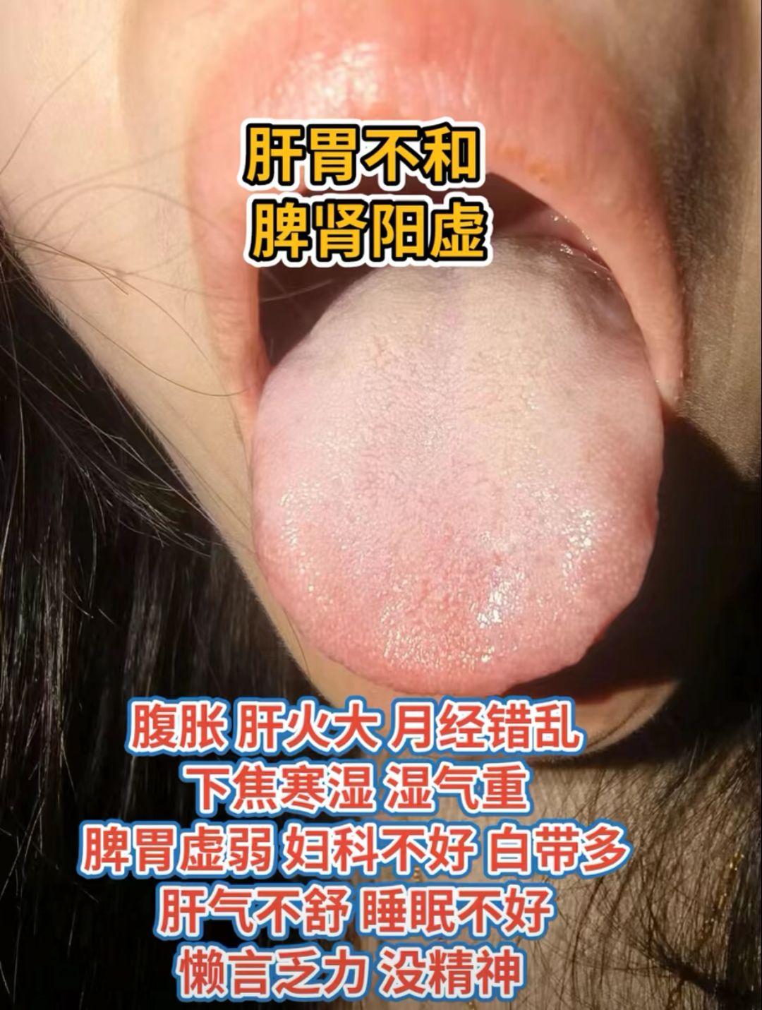 快看看你是哪种舌苔