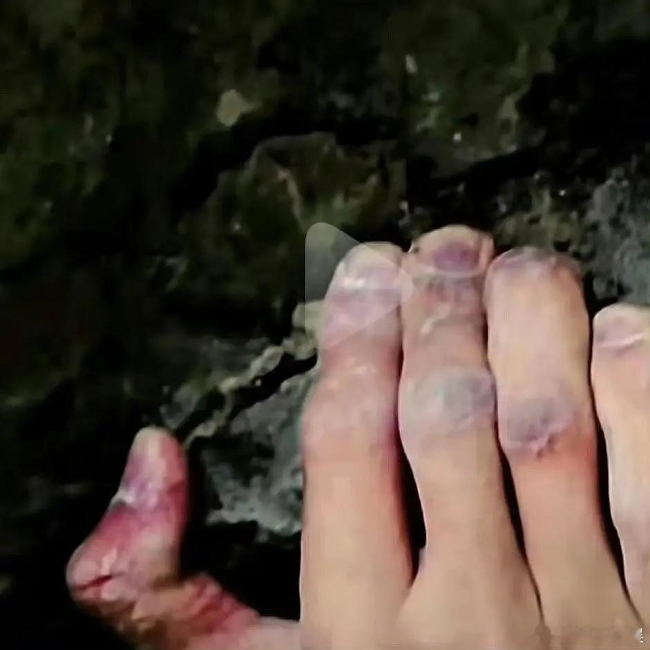 粉丝真的爱惨了王一博从不卖惨的性格吧，当时被造谣的手，换成某些流量必须是一波卖惨