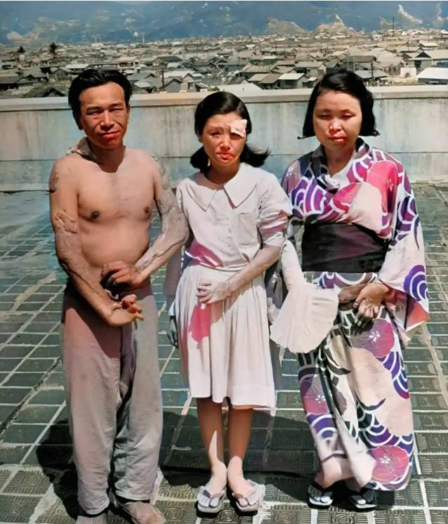 1945年，广岛原子弹爆炸后，三个幸存者，留下了这一张照片，镜头中的他们眼神非常
