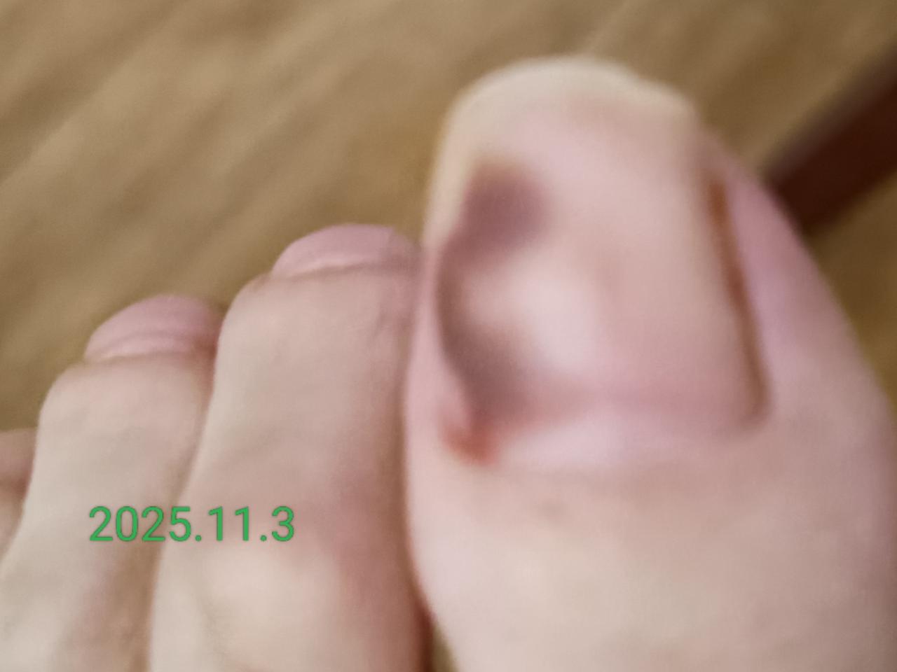清晨吃了一碗蒸鸡蛋，十点多提前备好午饭，吃过便动身去医院陪护母亲。哥哥总劝我少来