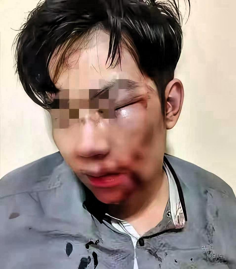 女子远嫁，老公觉得她娘家远经常家暴她。

今年春节，她想回家看望年迈的父母，却被