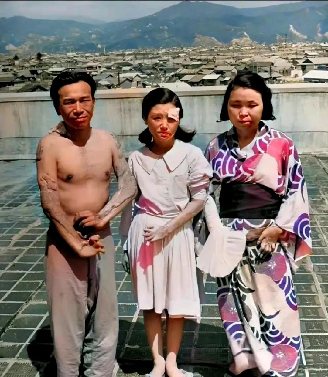 1945年，广岛原子弹爆炸后，三个幸存者，留下了这一张照片，镜头中的他们眼神非常